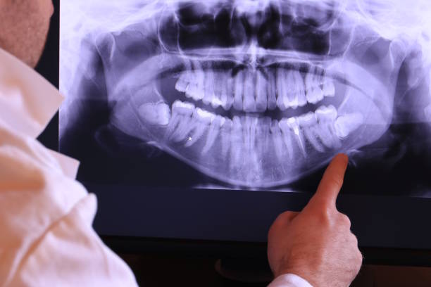 Best Emergency Care for Gum Disease in Shields, MI
