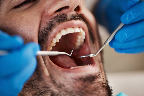 Best Walk-In Emergency Dental Services in Shields, MI